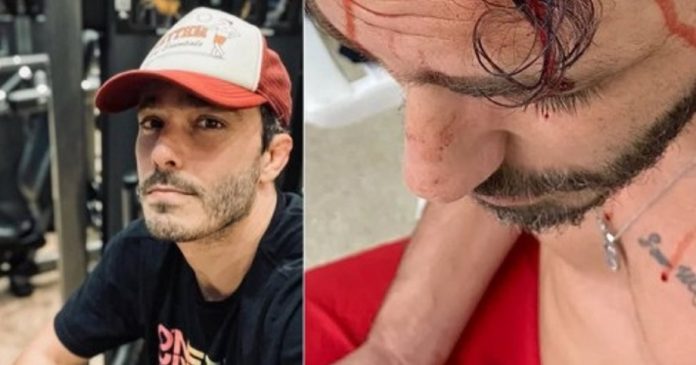 Thiago Rodrigues “está em choque” depois de ser espancado em assalto, diz empresária