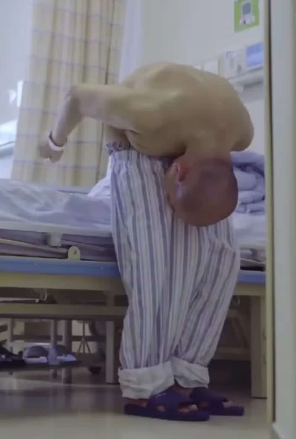 psicologiasdobrasil.com.br - Após cirurgia, 'Homem Dobrado' finalmente consegue ficar ereto e ter 'vida normal'