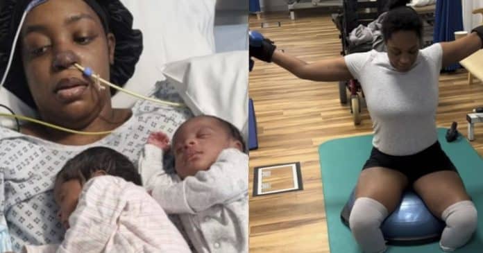 Mulher perde braços e pernas após dar à luz a gêmeos na Inglaterra
