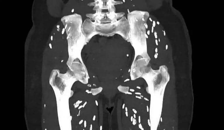 psicologiasdobrasil.com.br - Tomografia revela efeito devastador de consumir carne de porco malpassada