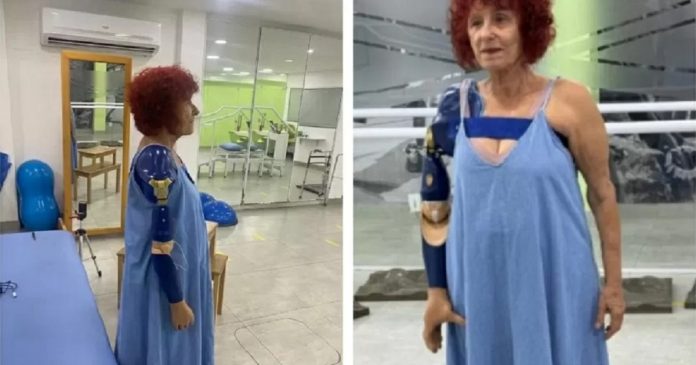 Roseana Murray usa prótese biônica pela primeira vez após ataque de pitbulls